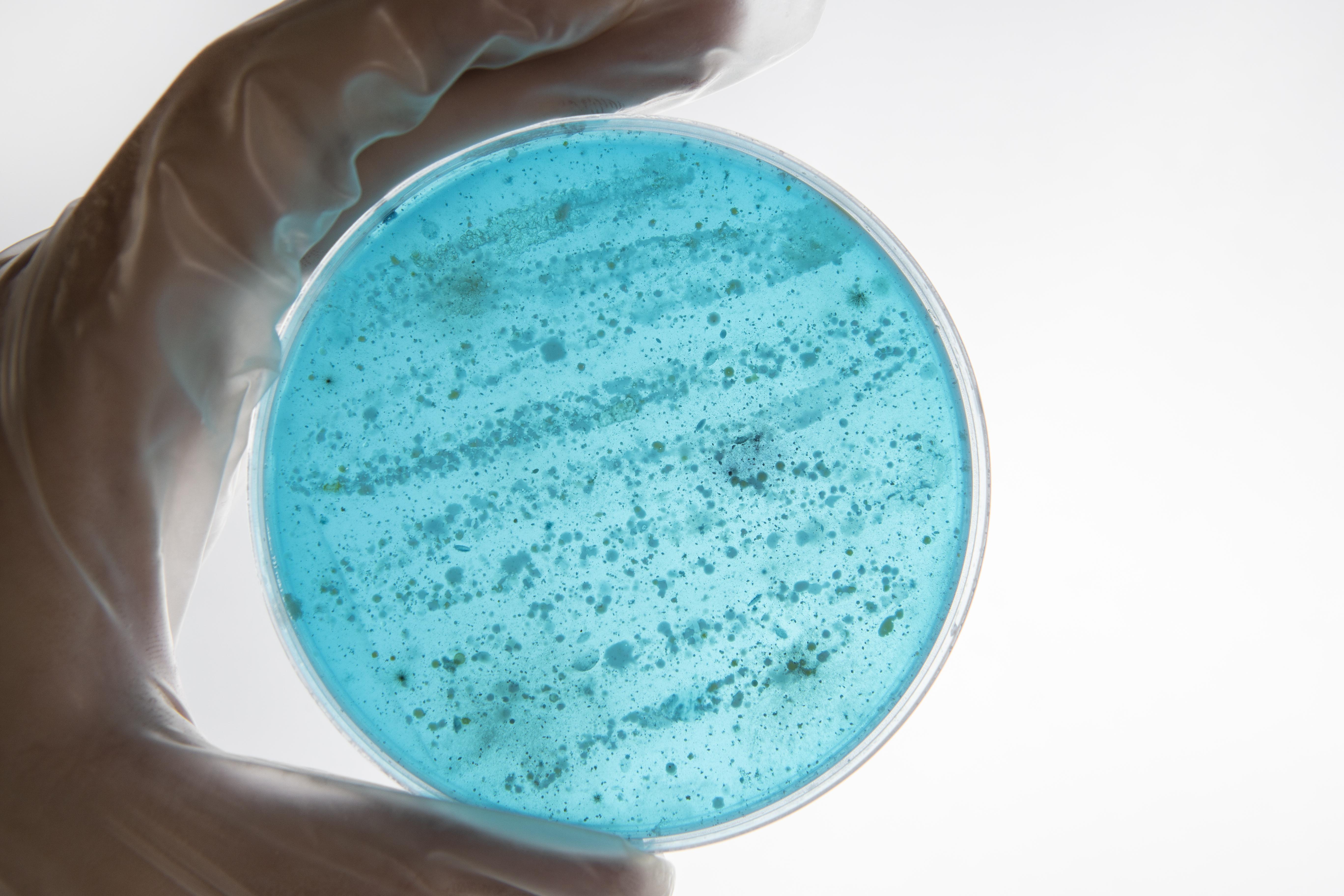 Microbial Coagulant